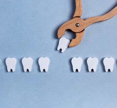 Detailed-Procedure-For-Wisdom-Tooth-Extraction-In-Whitefield
